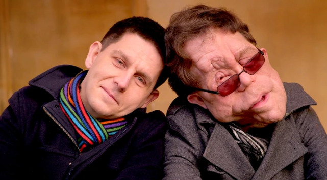 He was Born with a Rare Disease and Now Collaborates with Hollywood Stars